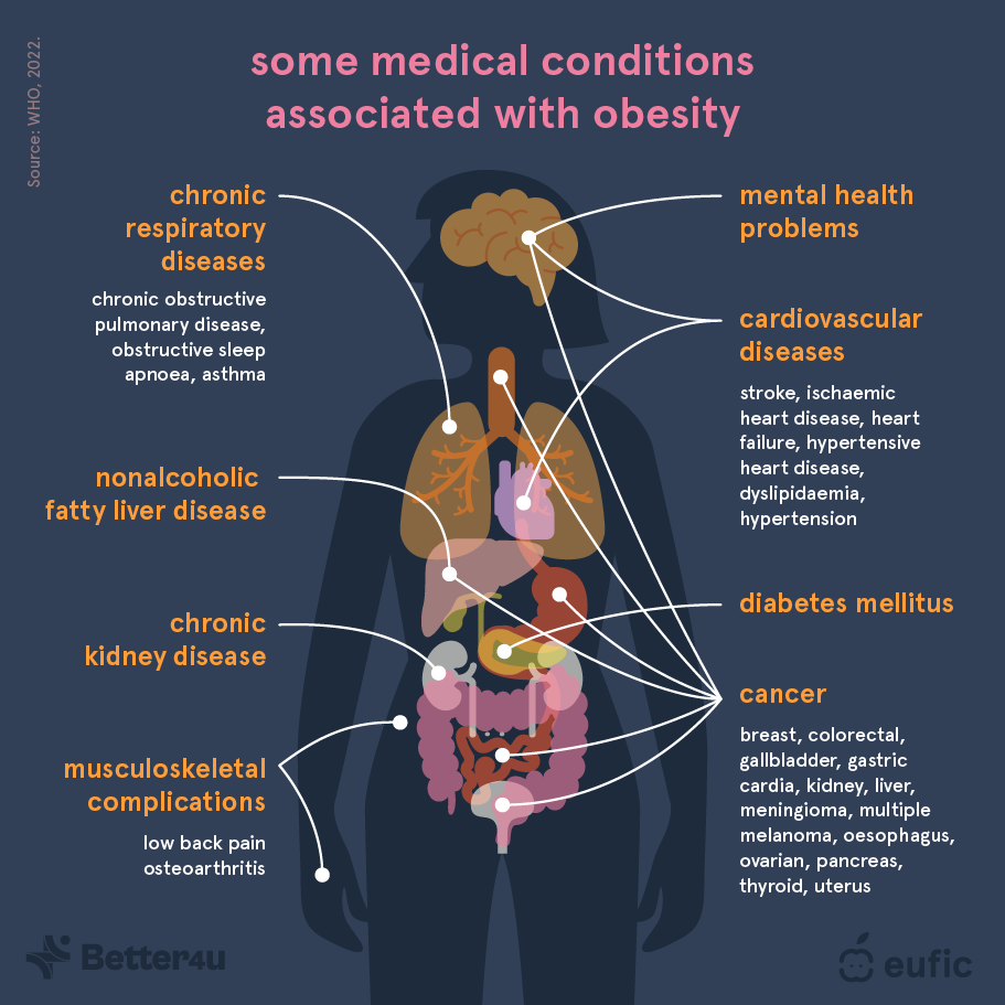 Obesity_definition,_causes_and_prevention_strategies_1_EN_1.png